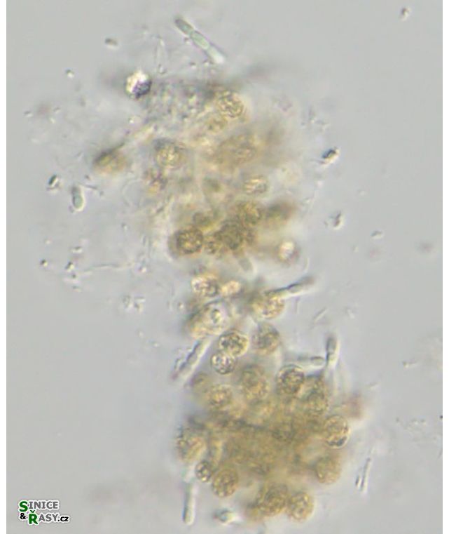 Pseudanabaena mucicola
