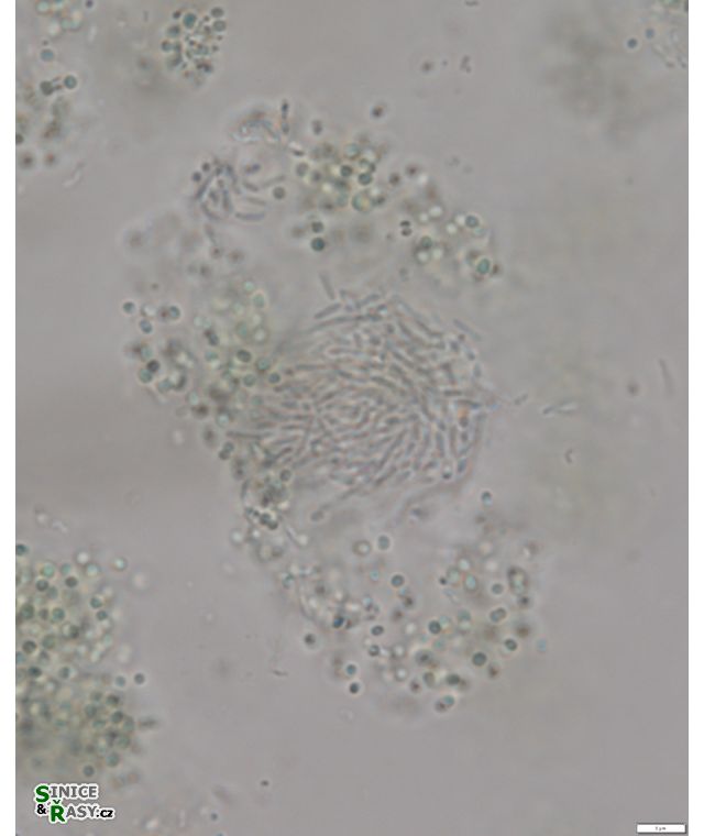 Synechococcus endogloeicus