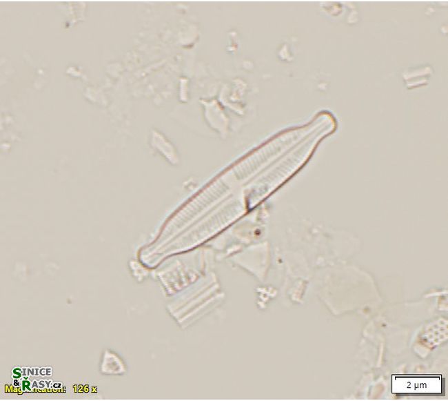 Stauroneis kriegerii