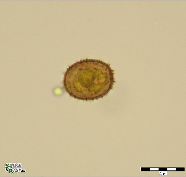 Trachelomonas