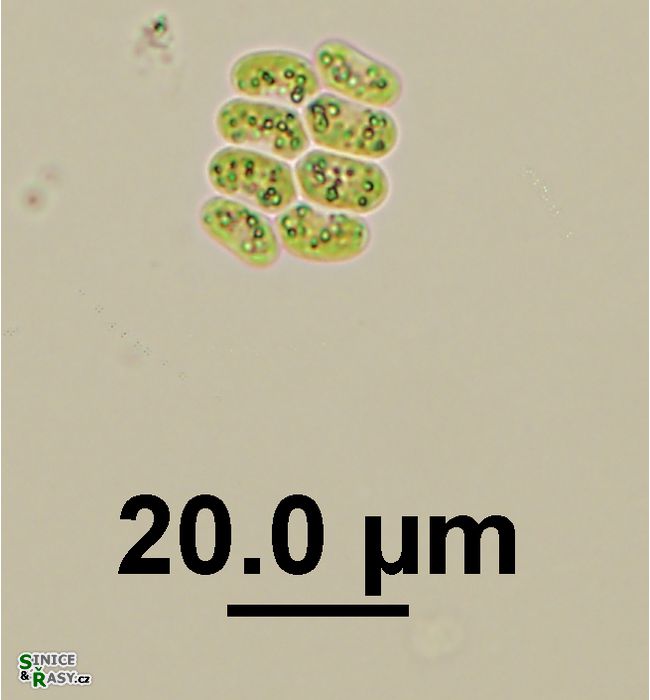 Scenedesmus obtusus var. disciformis