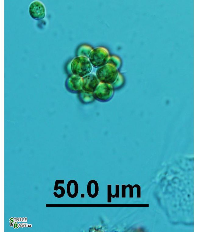 Coelastrum microporum