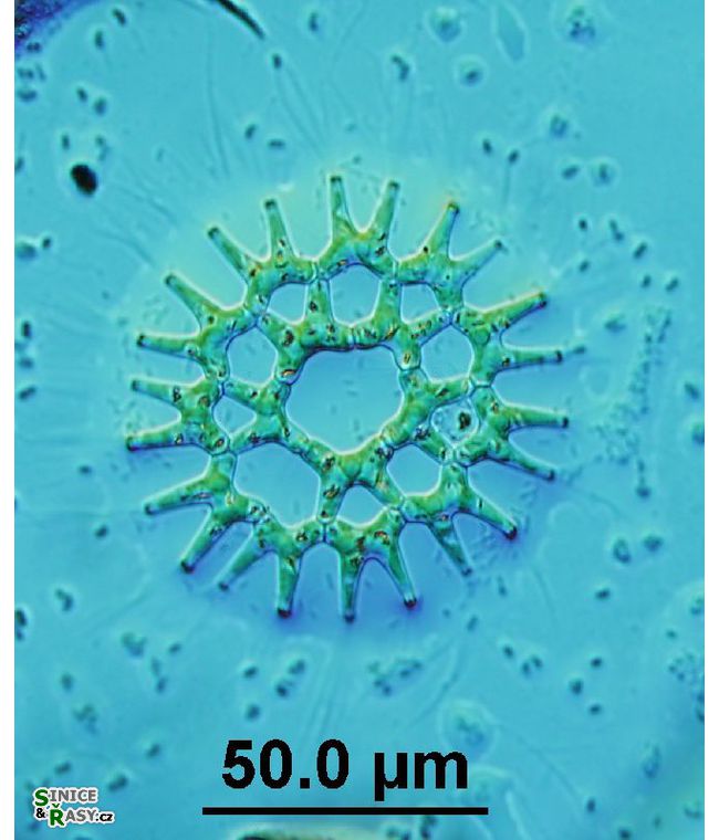 Lacunastrum gracillimum