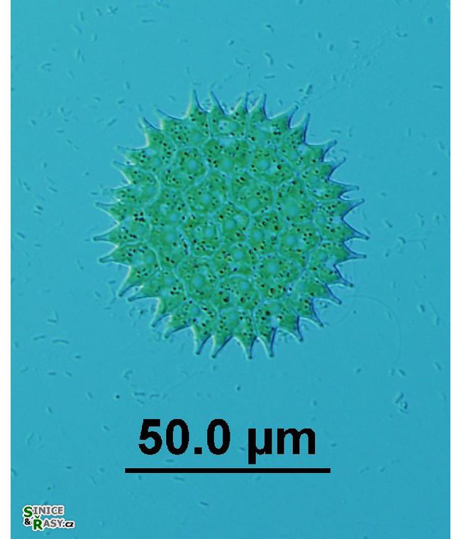 Pseudopediastrum boryanum