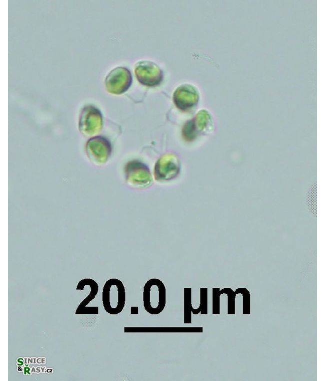 Dictyosphaerium ehrenbergianum
