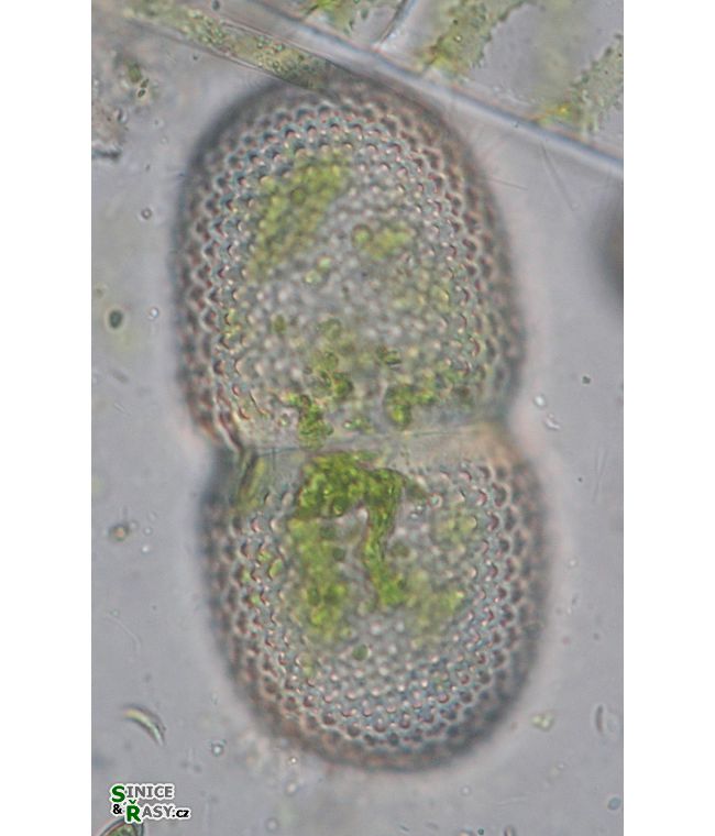 Cosmarium striolatum