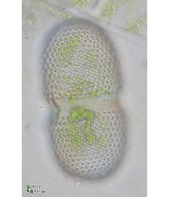 Cosmarium striolatum