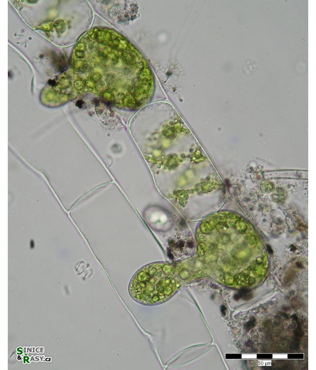 Spirogyra