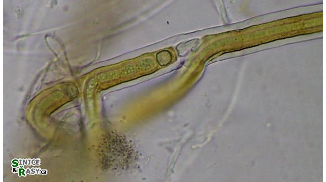 Scytonema