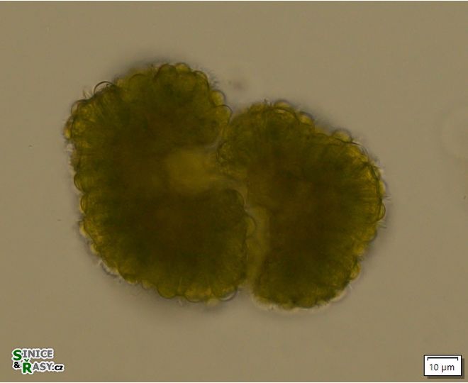 Botryococcus braunii