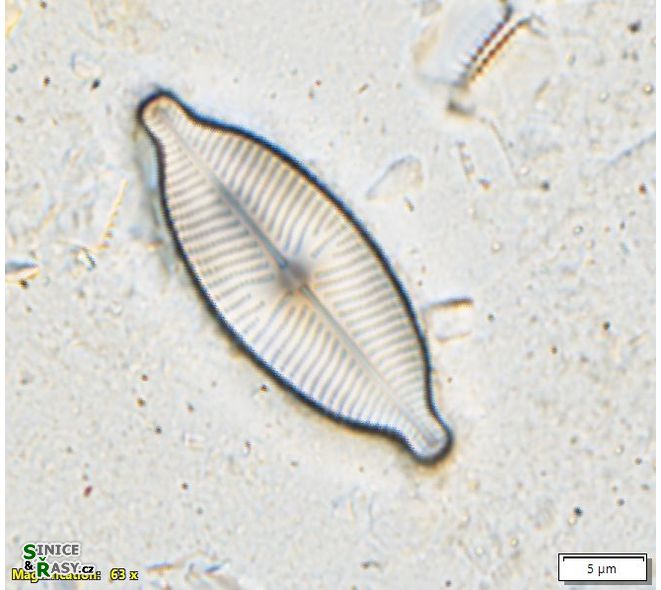 Placoneis symetrica