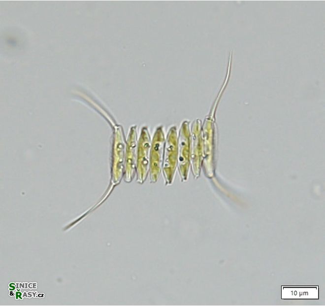 Desmodesmus protuberans