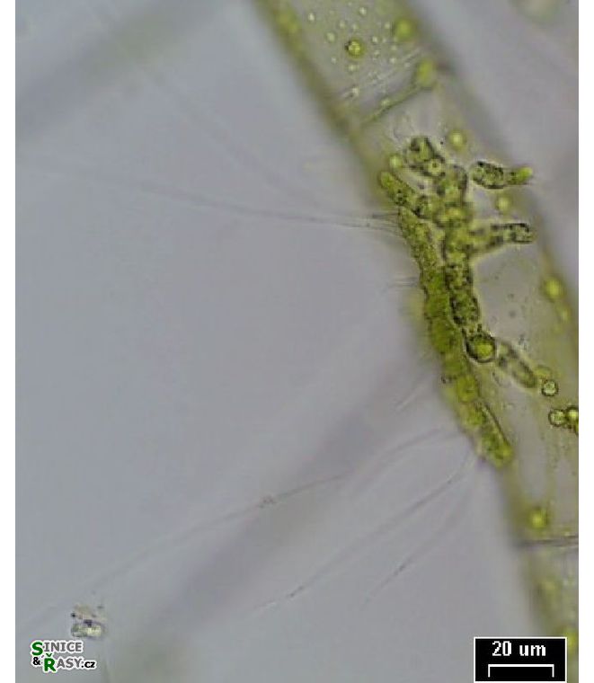 Aphanochaete sp. 