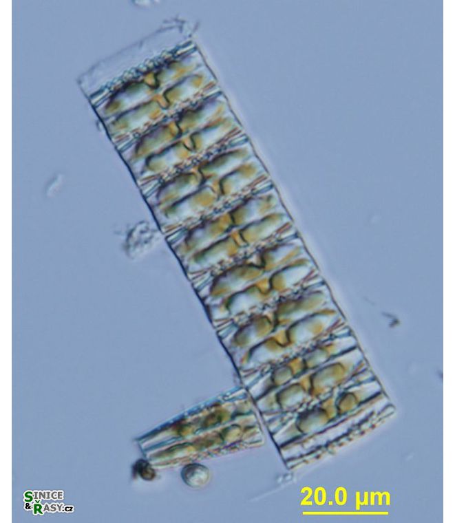 Diatoma