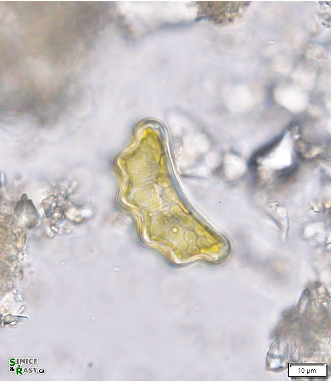 Eunotia tetraodon
