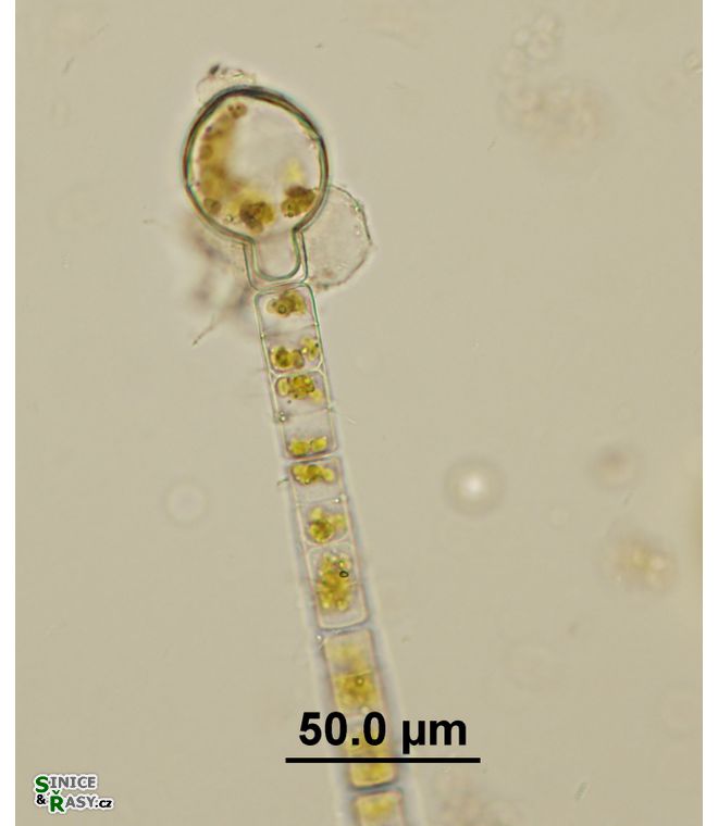Melosira varians