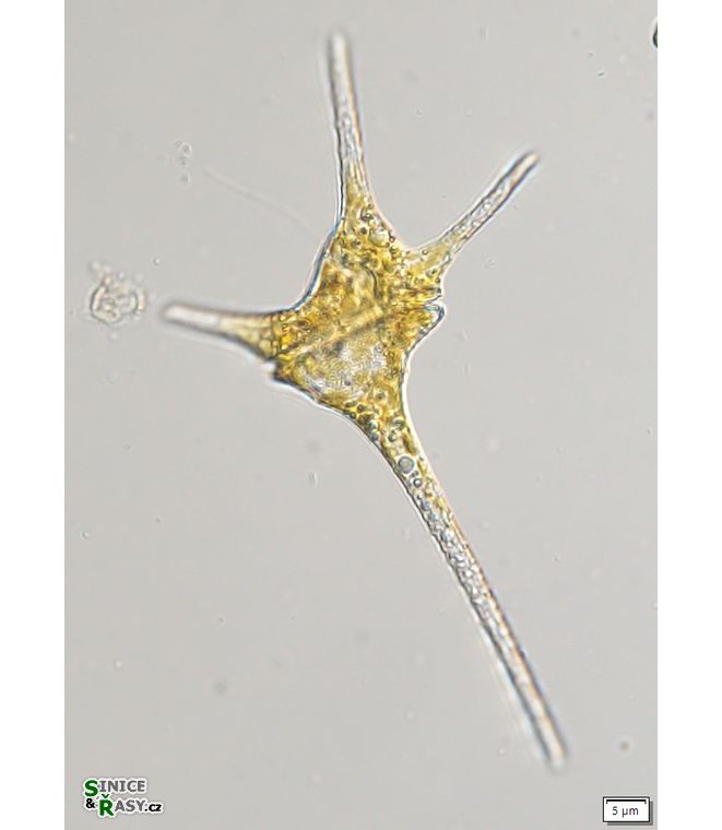 Ceratium hirundinella