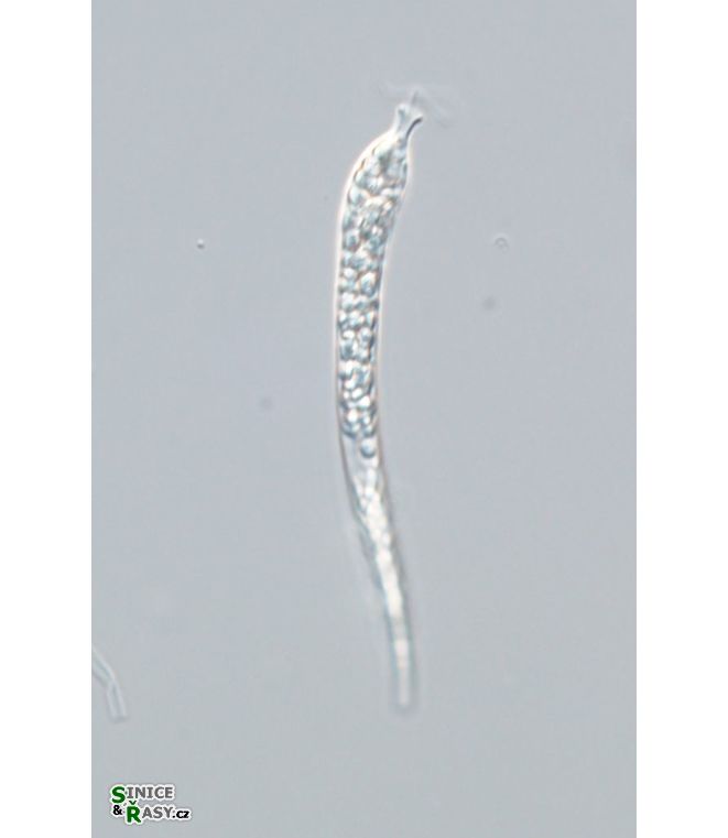 Astasia trotuosa