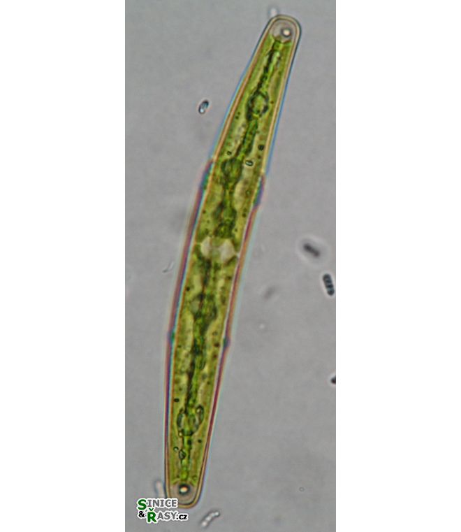 Closterium juncidum