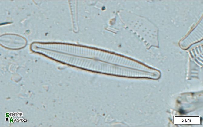 Encyonopsis falaisensis