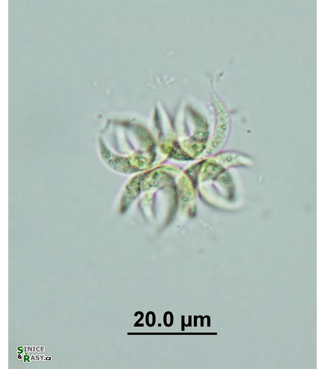 Selenastrum bibraianum