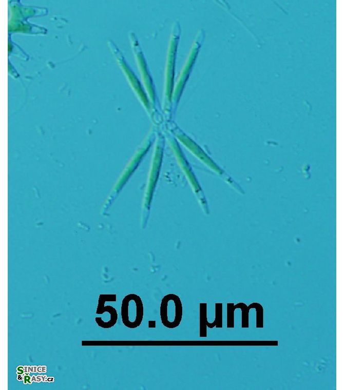 Actinastrum hantzschii