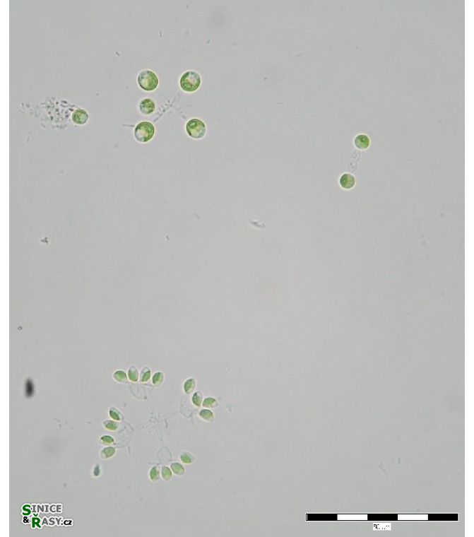 Mucidosphaerium sphagnale