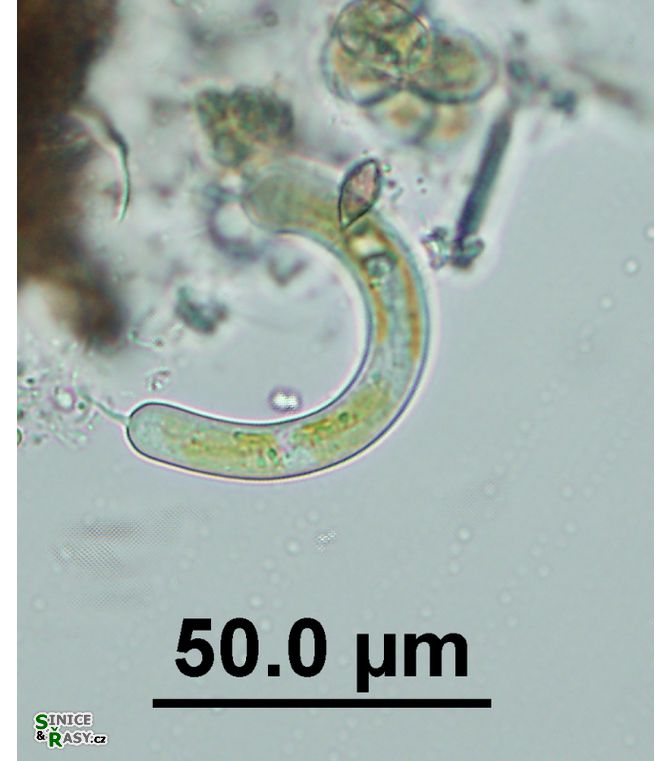 Ophiocytium bicuspidatum