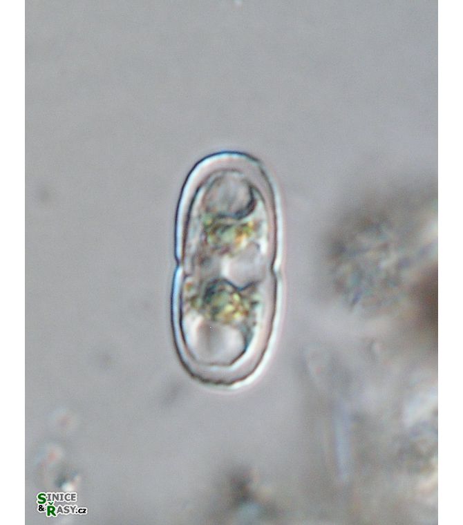 Actinotaenium kriegeri