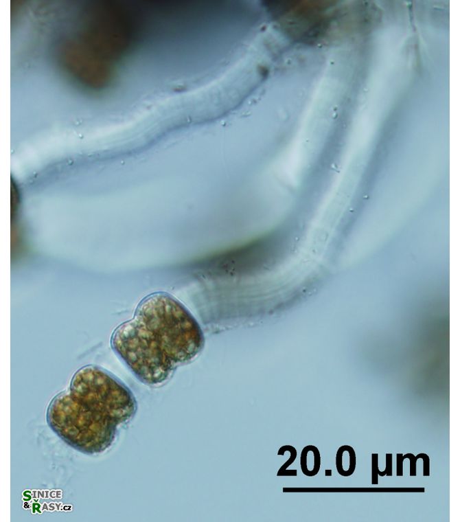 Vincularia roraimae