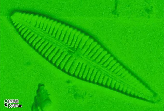 Gomphonema