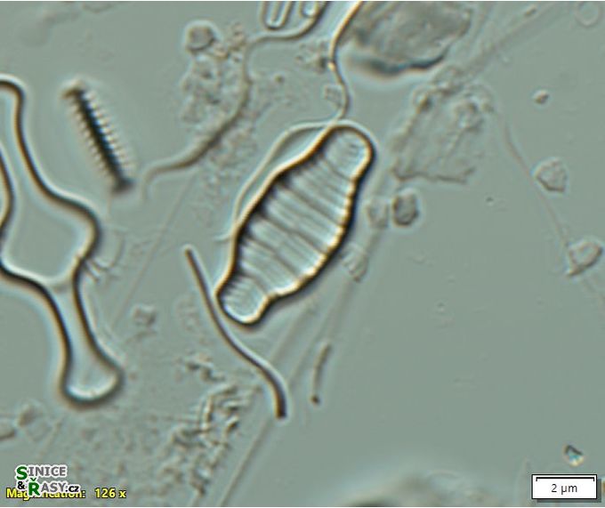 Odontidium anceps
