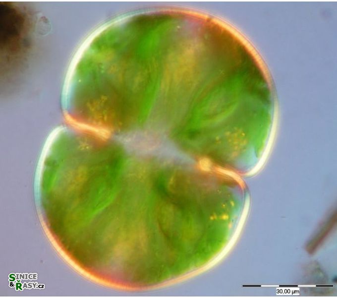 Cosmarium pachydermum