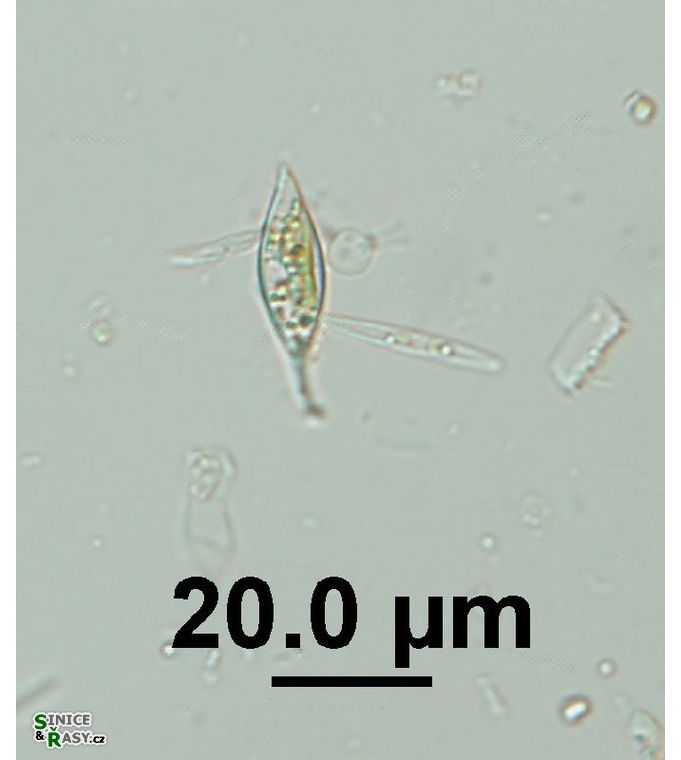 Characium cf. rostratum