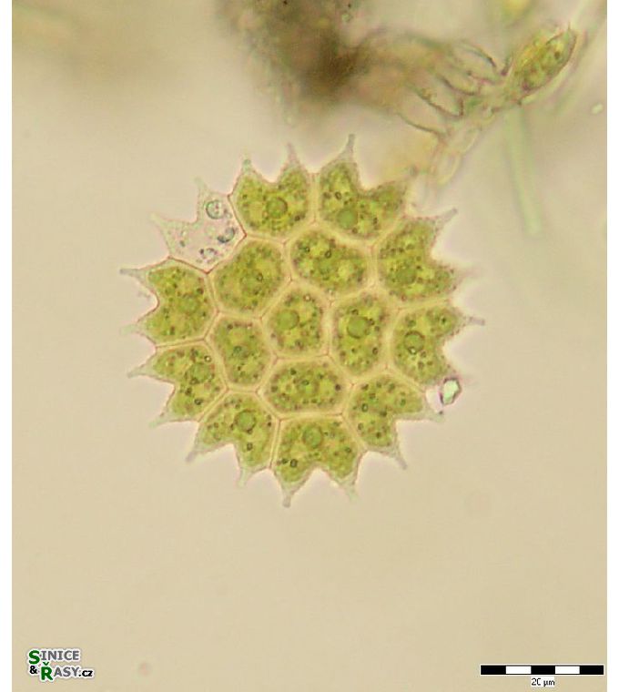 Pseudopediastrum boryanum