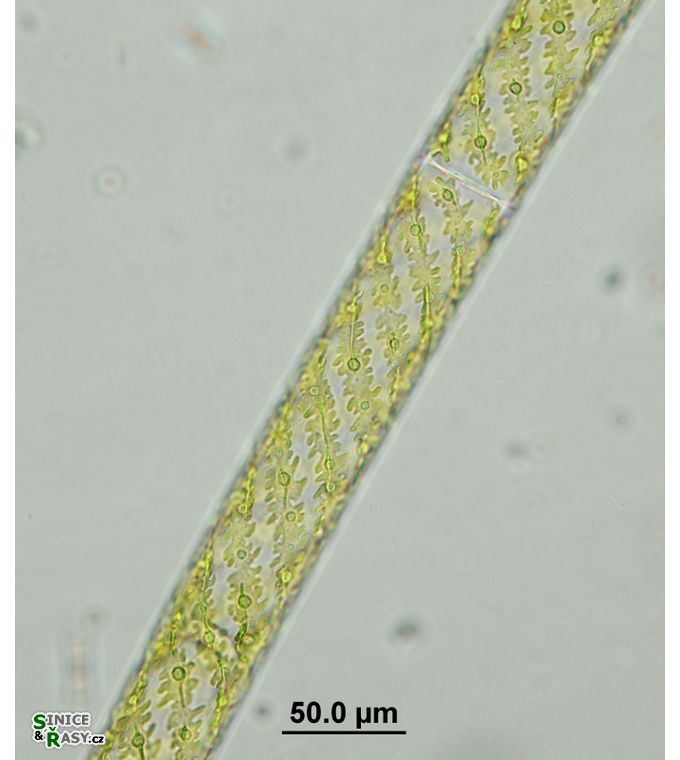 Spirogira