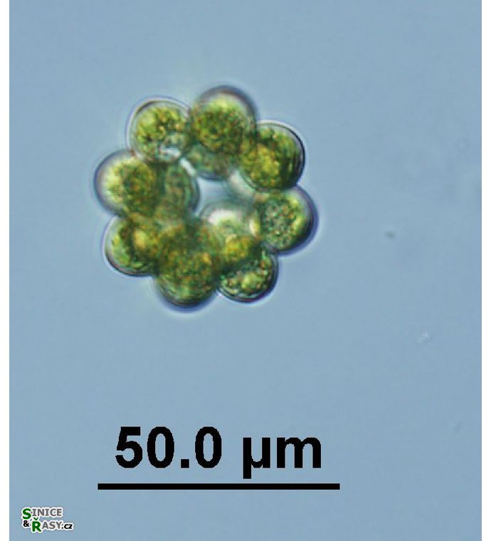 Coelastrum astroideum 