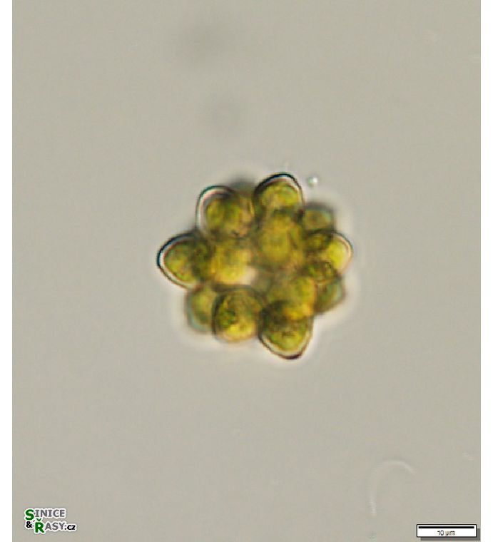 Coelastrum astroideum