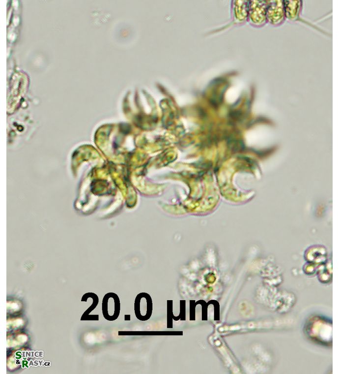 Kirchneriella