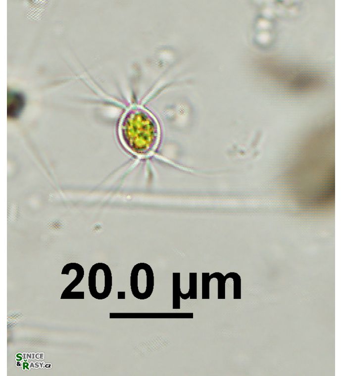 Lagerheimia longiseta