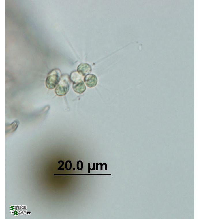 Micractinium pusillum