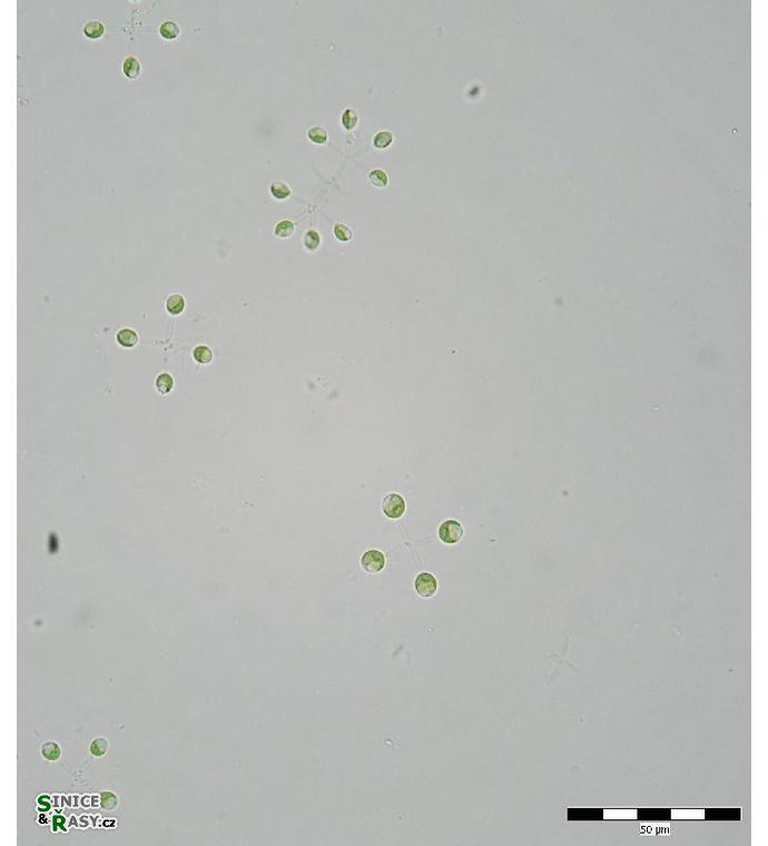 Mucidosphaerium sphagnale