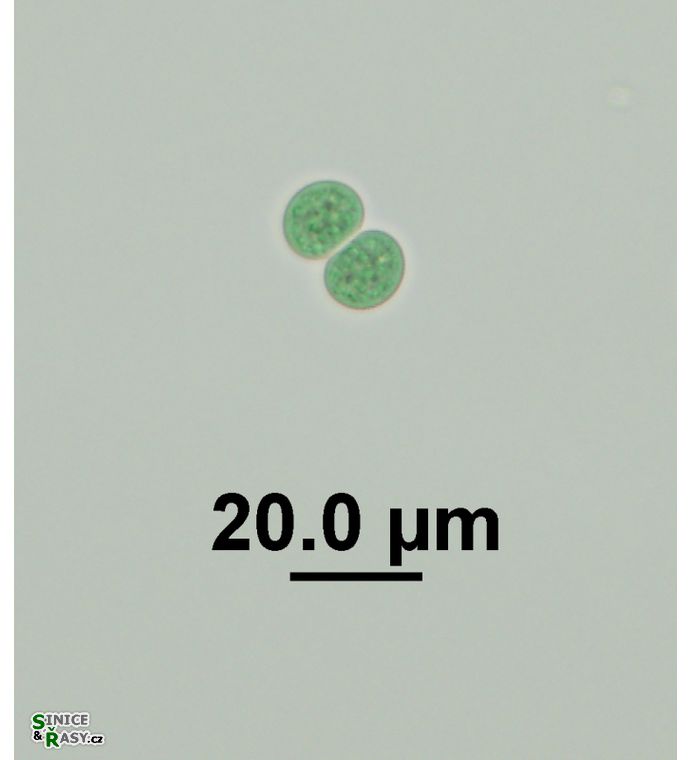 Chroococcus turgidus