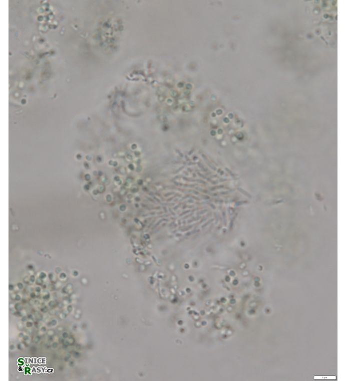 Synechococcus endogloeicus
