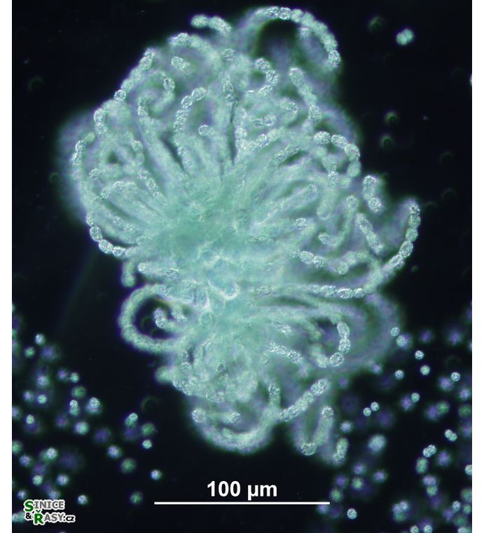 Dolichospermum lemmermannii