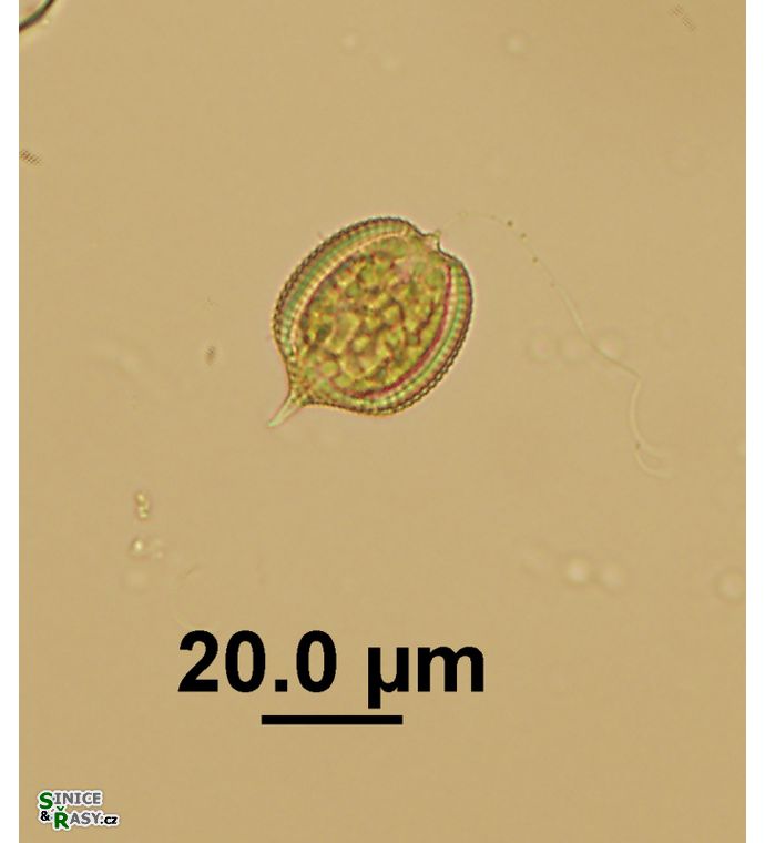 Phacus monilatus