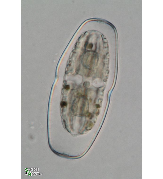 Actinotaenium cucurbitinum