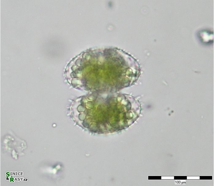 Staurastrum hirsutum