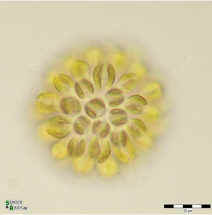 Synura uvella