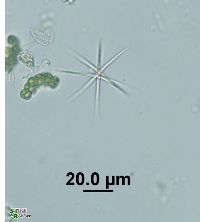 Ankistrodesmus fusiformis